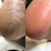 NAILSOFTHEDAY Podology+ Keratolytic for feet, 100 ml